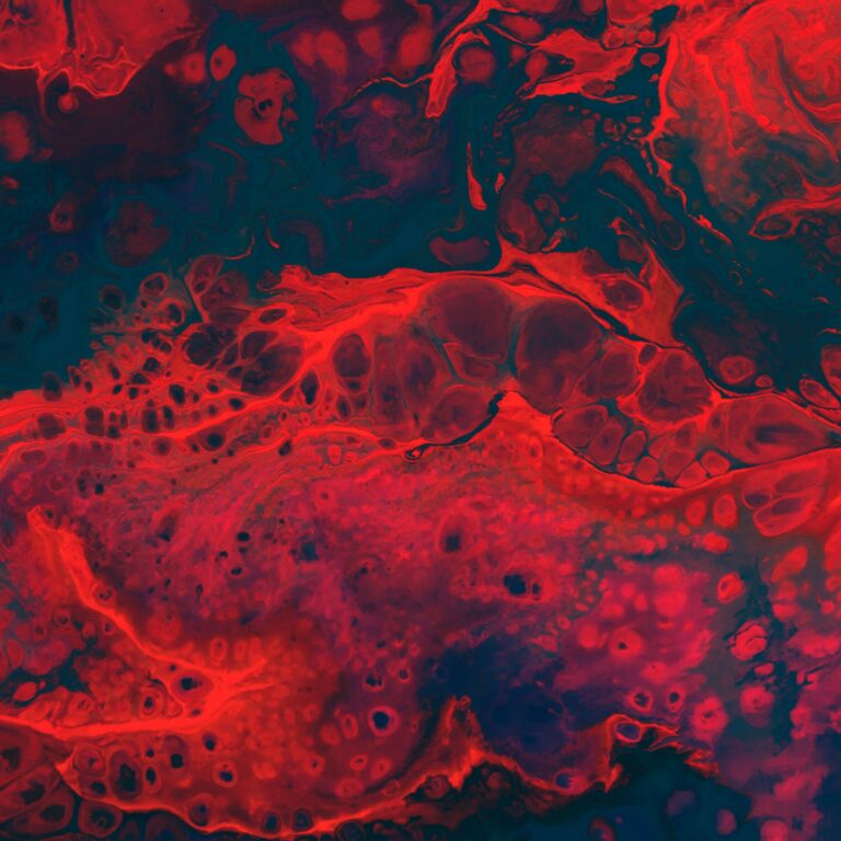 DISLIPIDEMIA: ABORDAGEM 360